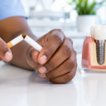 Smoking and dental implants: a hand snapping a cigarette in half beside a dental implant model.